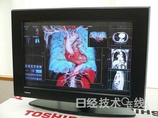 醫(yī)用裸眼3D顯示器，開(kāi)始用于腦神經(jīng)外科手術(shù)-廣州磐眾智能科技有限公司